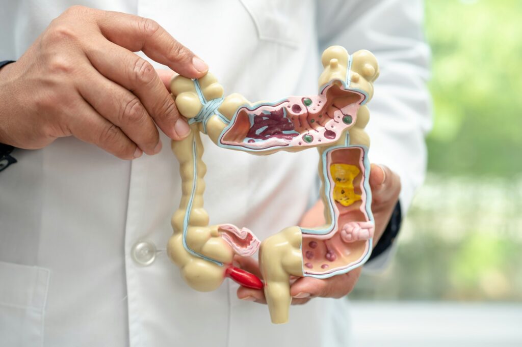 Intestine, appendix and digestive system, doctor holding anatomy model for study diagnosis.