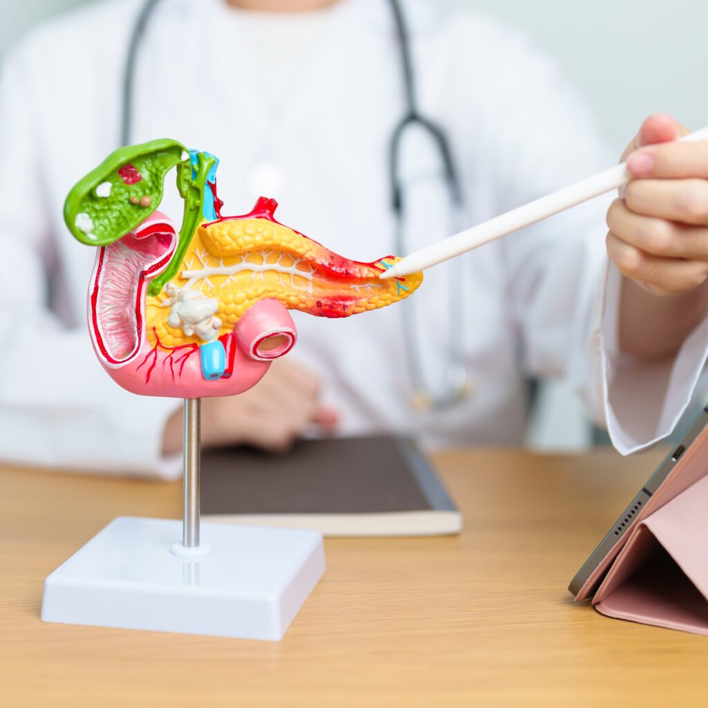 Doctor with human Pancreatitis anatomy model with Pancreas