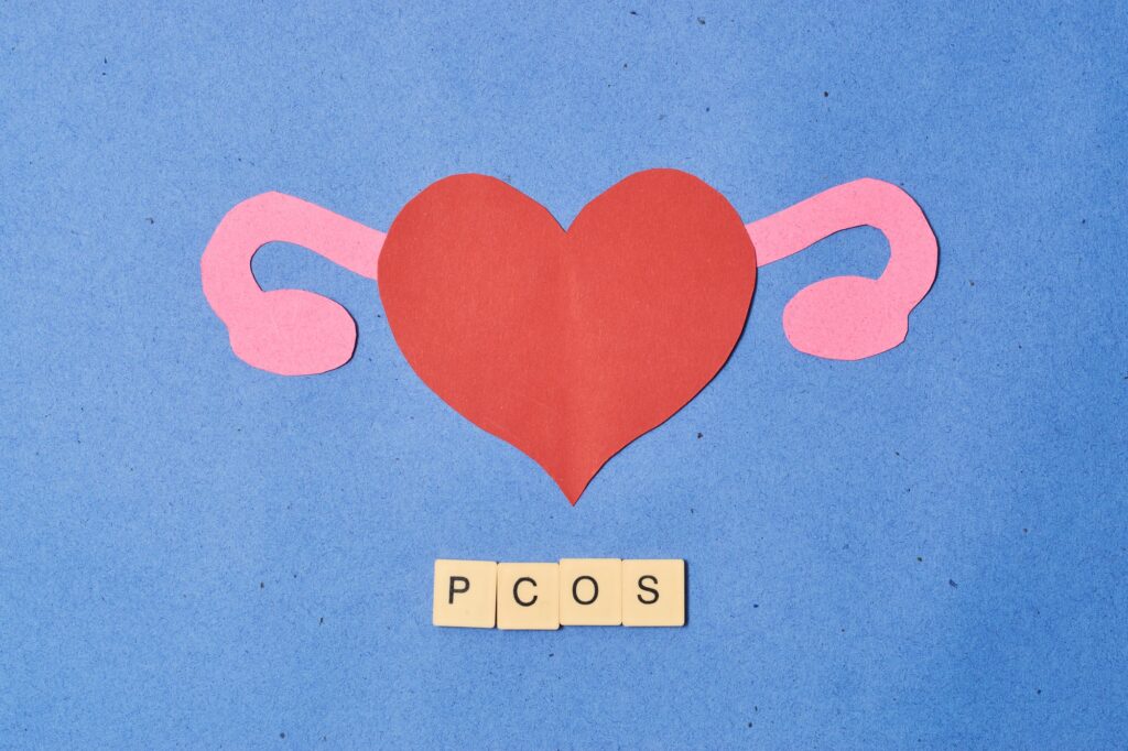 PCOS: Symptomen, Soorten & Behandeling – Wat Je Moet Weten
