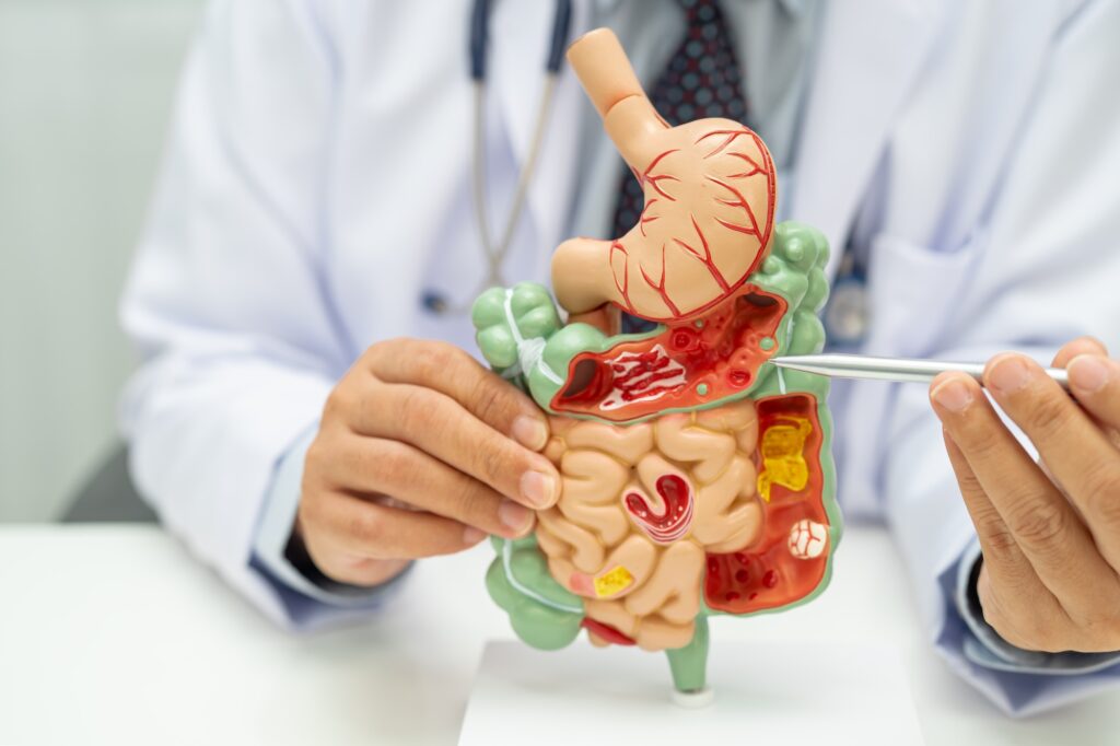 Digestive system with stomach and intestine, Asian doctor holding human anatomy